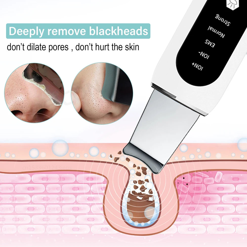 Ultrasonic Skin Scrubber Deep Cleansing Blackhead Remove