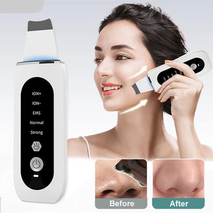 Ultrasonic Skin Scrubber Deep Cleansing Blackhead Remove